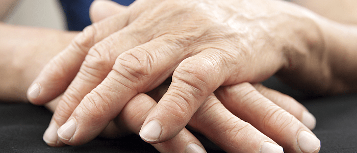 Reumatoïde artritis | Mijn Gezondheidsgids