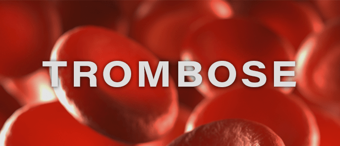 Het risico van trombose | Mijn Gezondheidsgids
